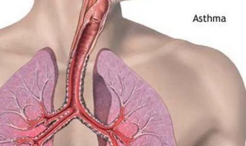 Alergia respiratorie (astm bronsic alergic)